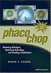 Phaco Chop: Mastering Techniques, Optimizing Technology, and Avoiding Complications