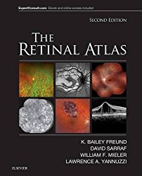 The Retinal Atlas, 2e