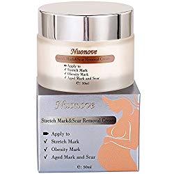 Stretch Mark Cream for Pregnancy, Stretch Mark Scar Cream, Postpartum Obesity Pregnancy Cream, Remove Stretch Marks From Pregnancy, Repair Scar Slack Line Abdomen Stretch Marks Postpartum