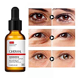 Angmile Caffeine Eye Serum Reduce Puffy Eyes, Dark Circles, Fine Lines, Wrinkles for Under and Around Eyes